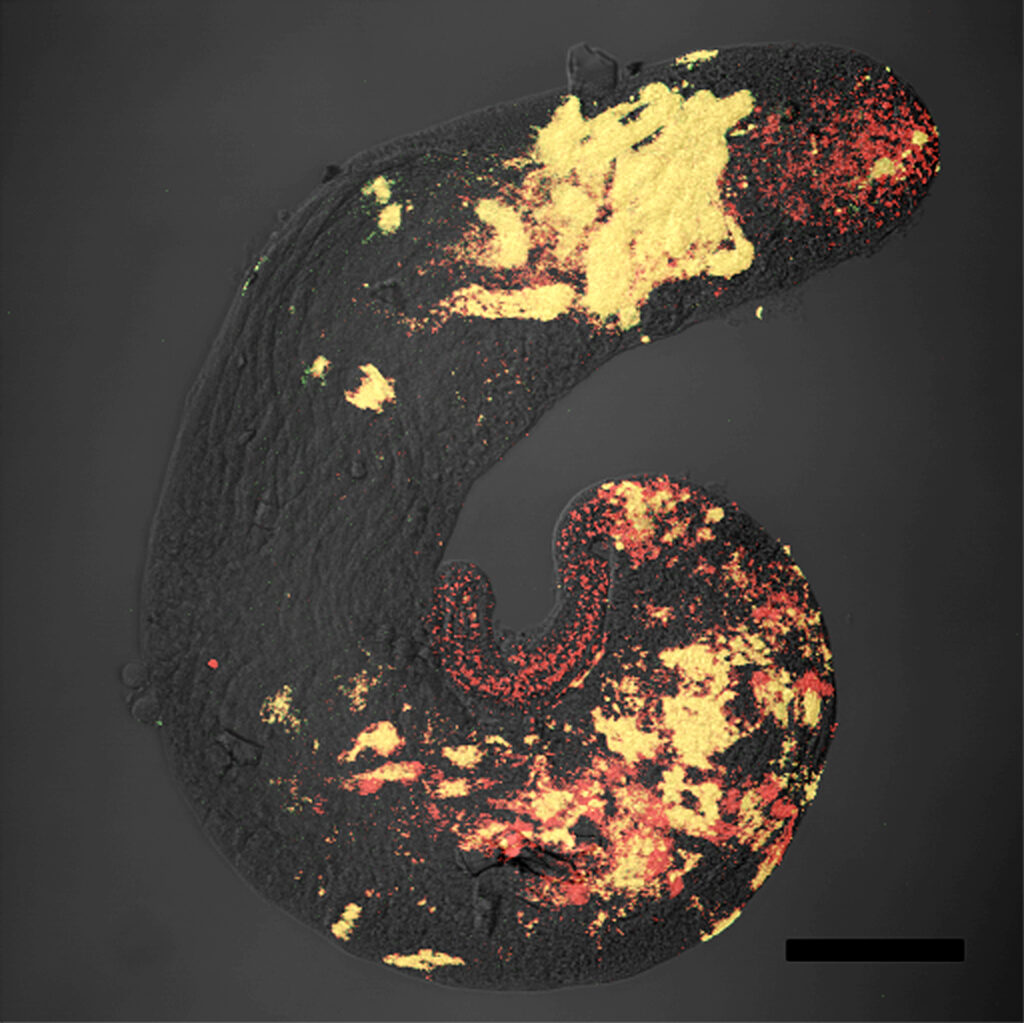 Wolbachia_in_Drosophila